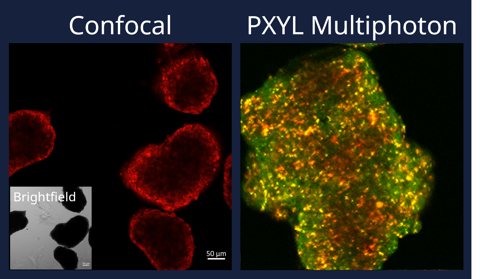 3D organoid imaging