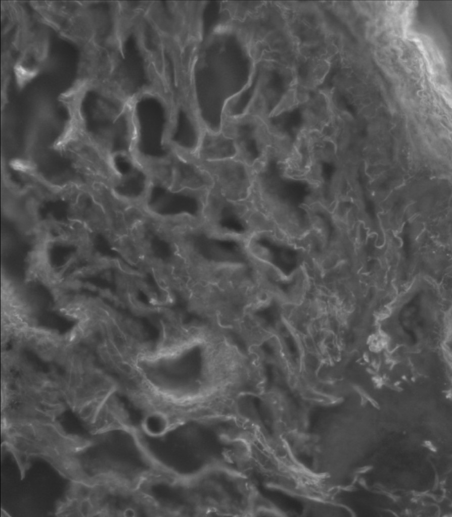 UV fluorescence microscopy