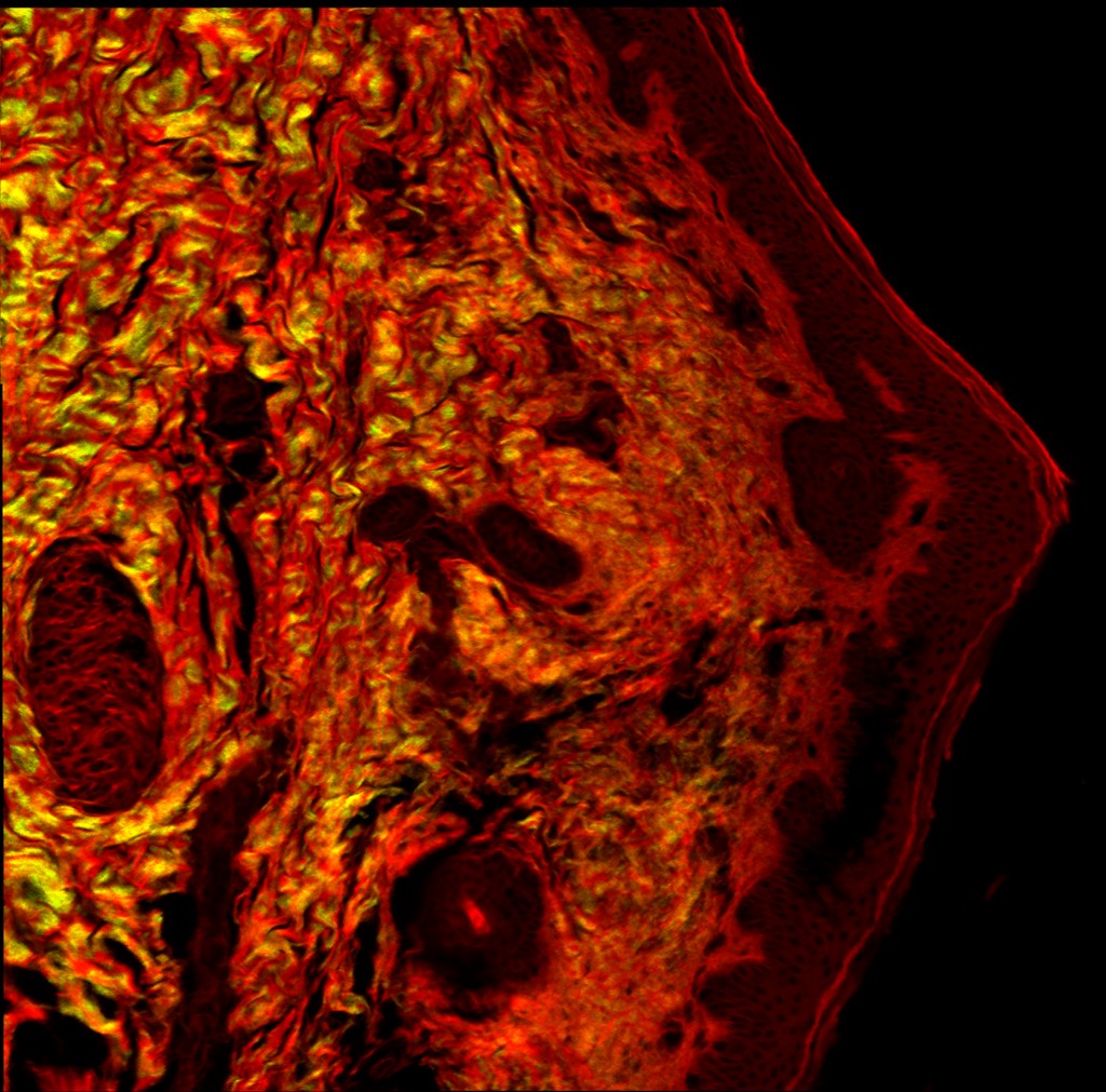 Multi-contrast nonlinear bioimaging
